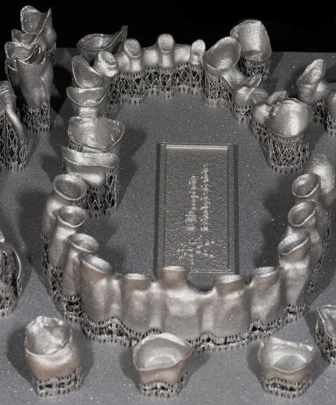 Machine de fusion laser pour prothèses dentaires en cobalt-chrome - CTD Rouen